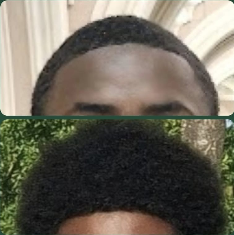 A before and after comparison showing a boy's hair growth