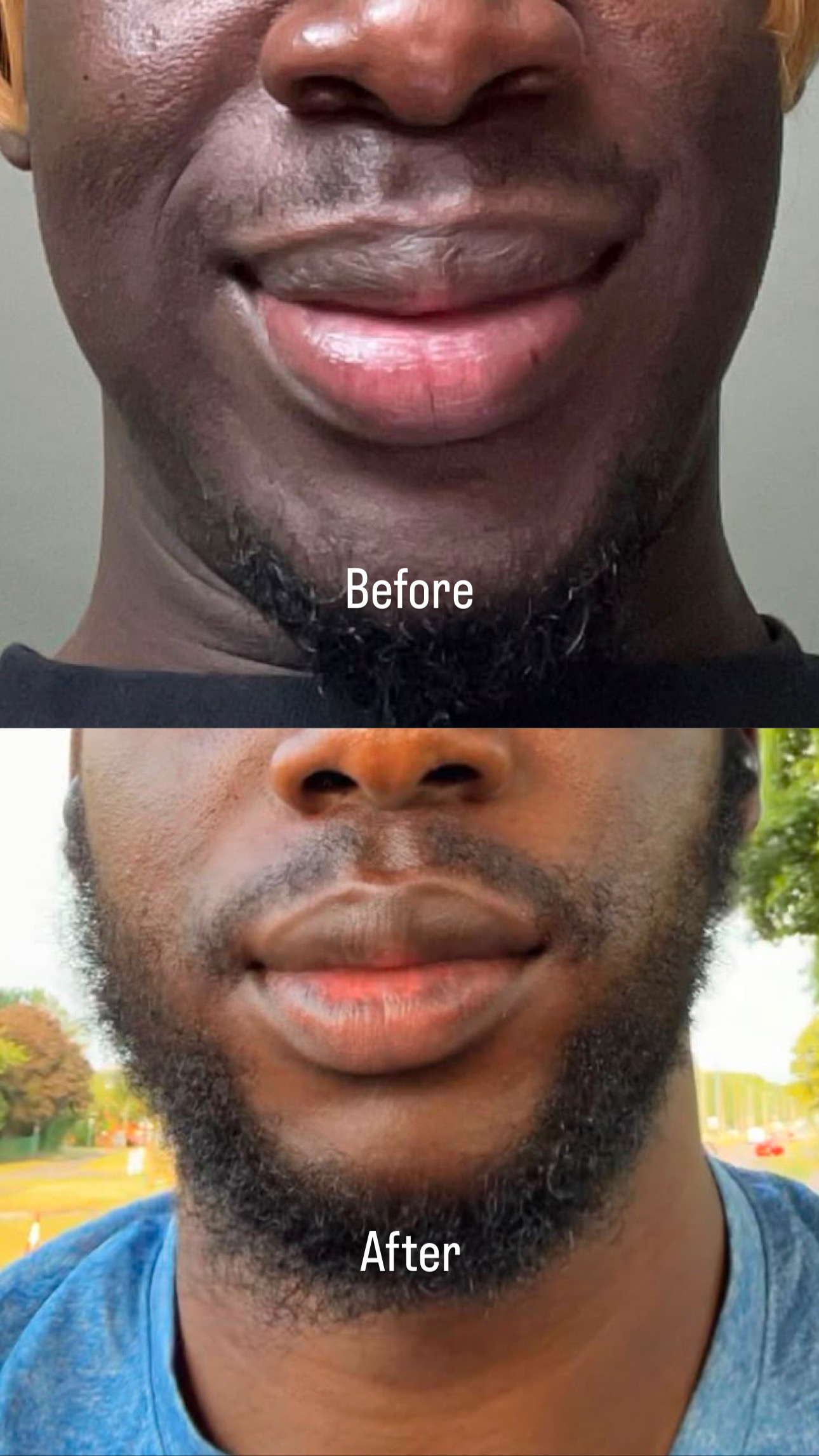 A before and after comparison showing a man's beard growth